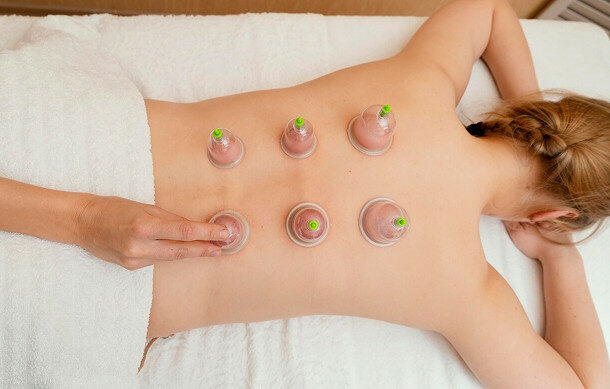 Is dynamic cupping just a fad let’s clear that up.
