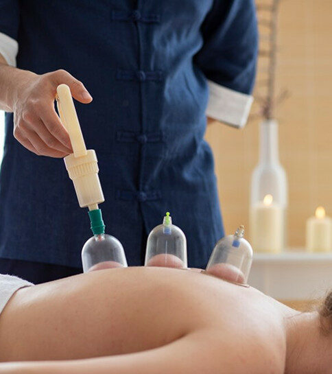 What is dynamic cupping massage